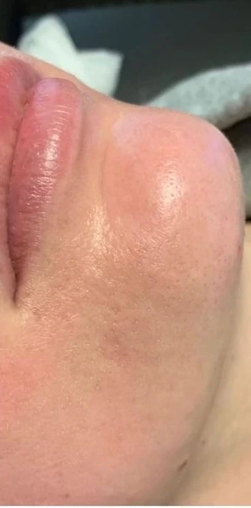 Faciales: resultado real